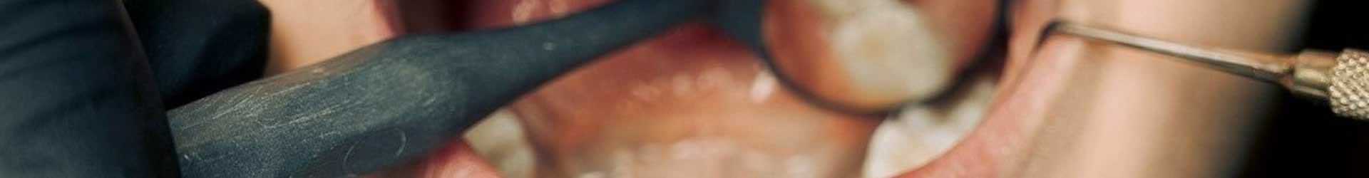 Mouth