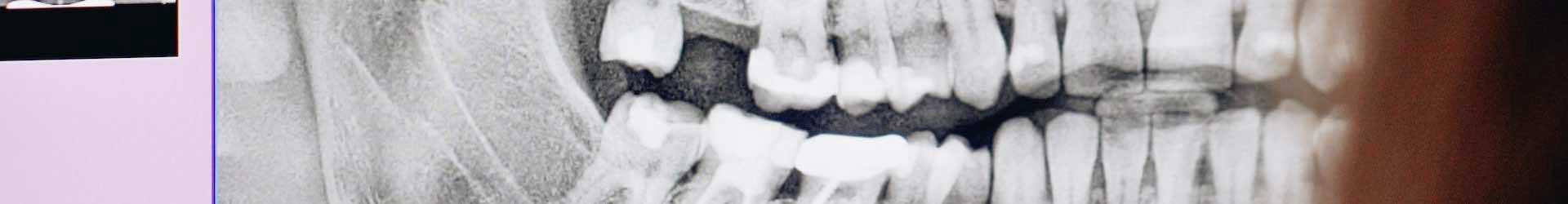 X-ray